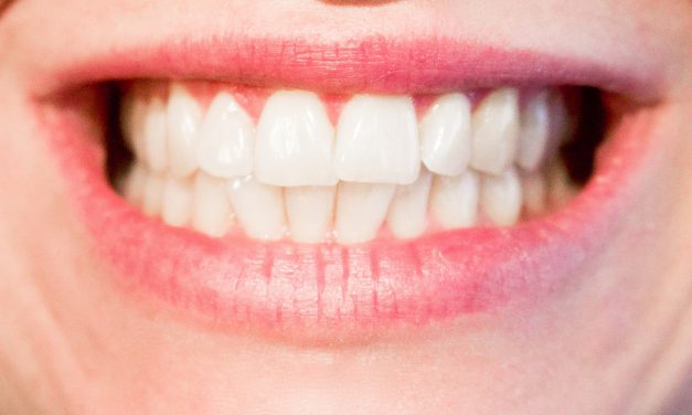 5 tips voor een gezonde mond en mooie tanden